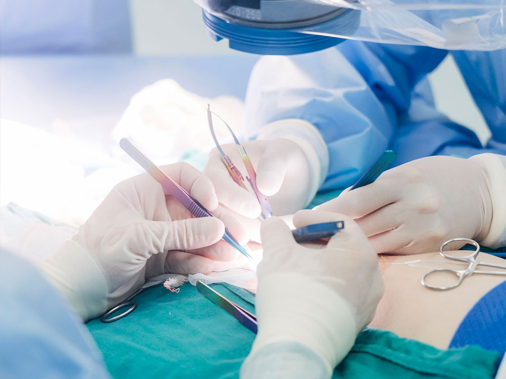 治療中の様子の写真